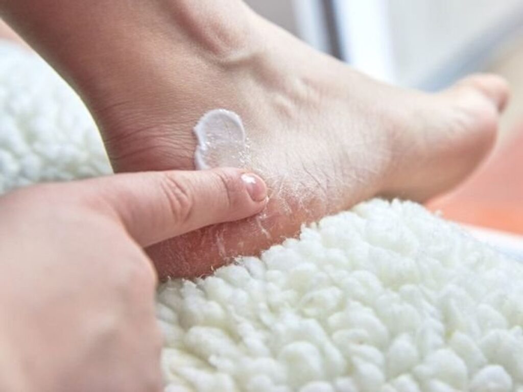 What Causes Cracked Heels | Body Care | NIVEA